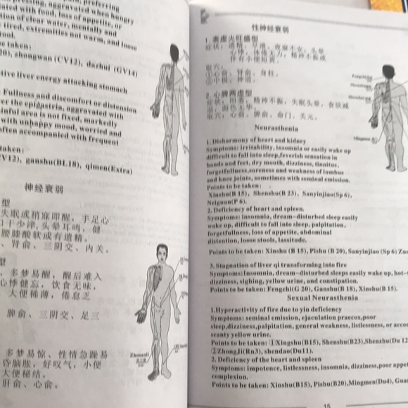 Traditional Chinese 12-Cup Cupping Therapy Massage Set - Picture 8 of 8